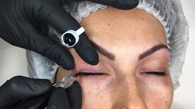 TP – EL sur la paupière supérieure