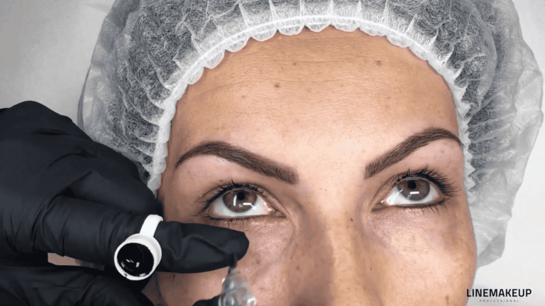 TP – EL sur la paupière inférieure