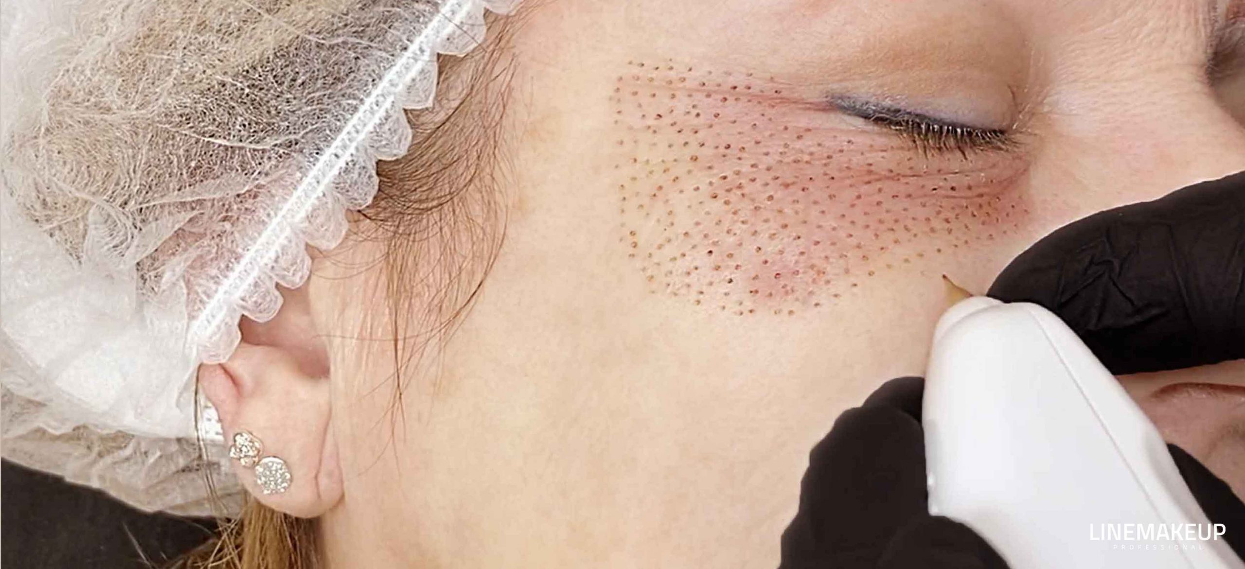 Formation-Plasmalift-Linemakeup-Julia-Mechenici-Rectangle